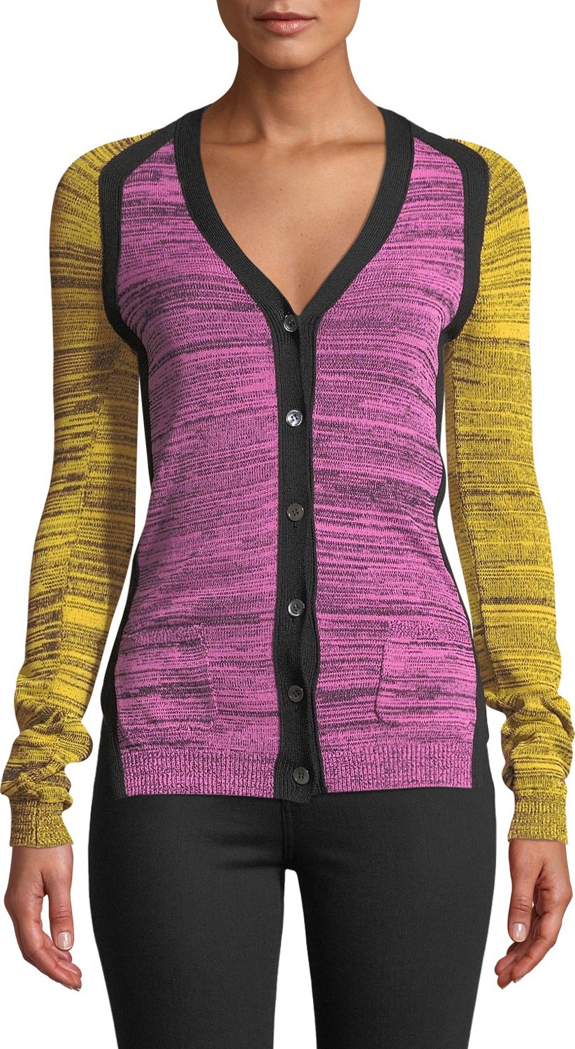 Nº21 Striped And Lace Cardigan